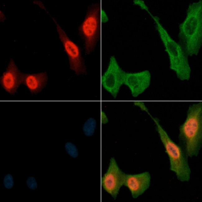 Phospho-RSK1 (Thr573) Antibody in Immunocytochemistry (ICC/IF)