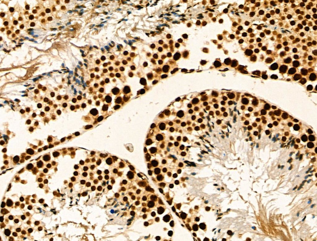 Phospho-RSK1 (Thr573) Antibody in Immunohistochemistry (Paraffin) (IHC (P))