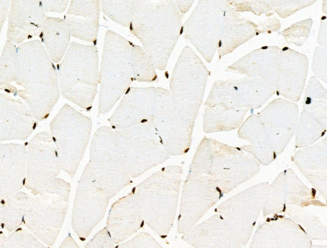 Phospho-RSK1 (Thr573) Antibody in Immunohistochemistry (Paraffin) (IHC (P))