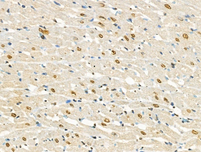 Phospho-RSK1 (Thr573) Antibody in Immunohistochemistry (Paraffin) (IHC (P))