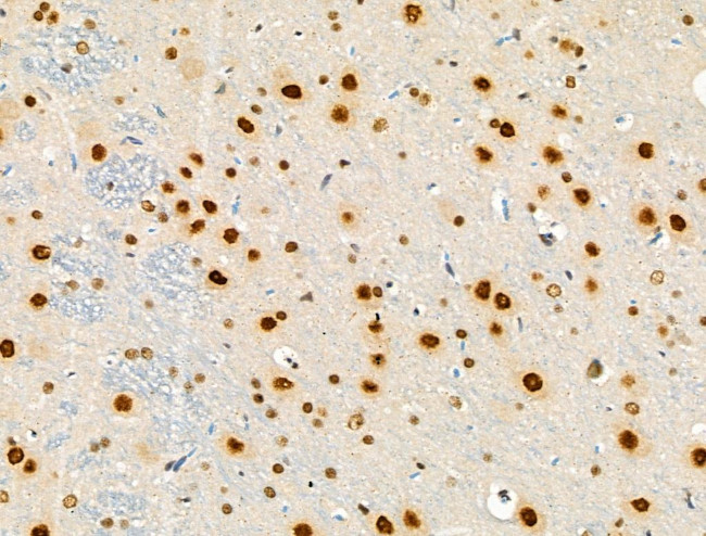 Phospho-RSK1 (Thr573) Antibody in Immunohistochemistry (Paraffin) (IHC (P))