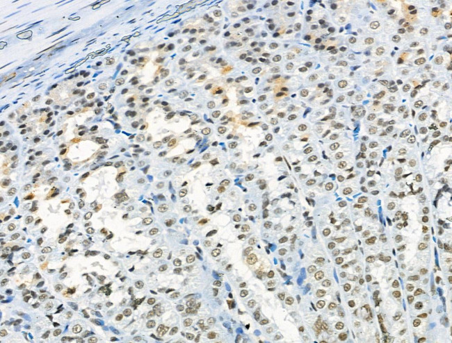 Phospho-RSK1 (Thr573) Antibody in Immunohistochemistry (Paraffin) (IHC (P))