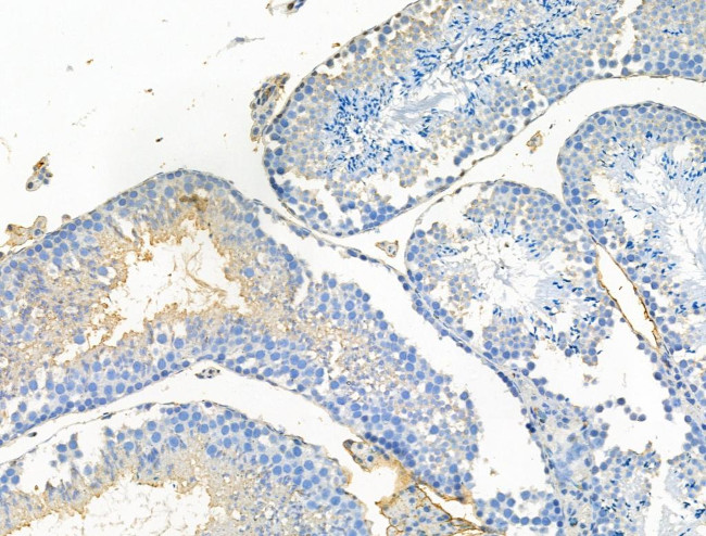 Phospho-GKAP1 (Ser25) Antibody in Immunohistochemistry (Paraffin) (IHC (P))