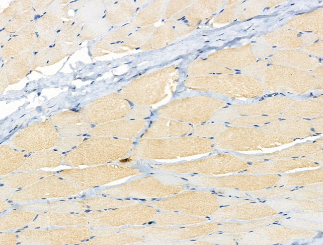 Phospho-GEF-H1 (Ser886) Antibody in Immunohistochemistry (Paraffin) (IHC (P))