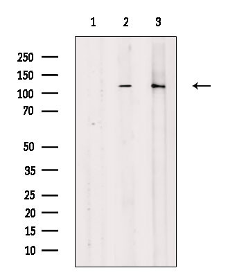 Phospho-GEF-H1 (Ser886) Antibody in Western Blot (WB)