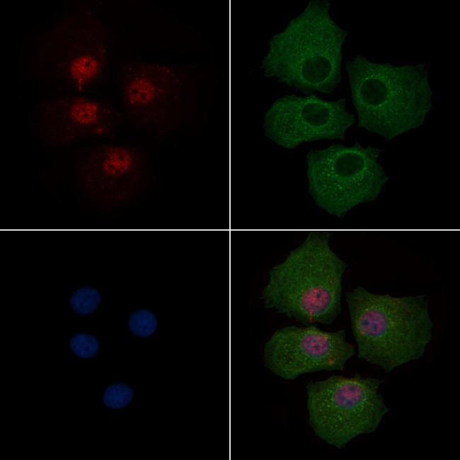 Phospho-PAR4 (Thr163) Antibody in Immunocytochemistry (ICC/IF)