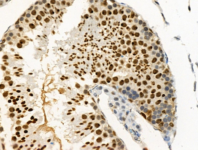 Phospho-PAR4 (Thr163) Antibody in Immunohistochemistry (Paraffin) (IHC (P))