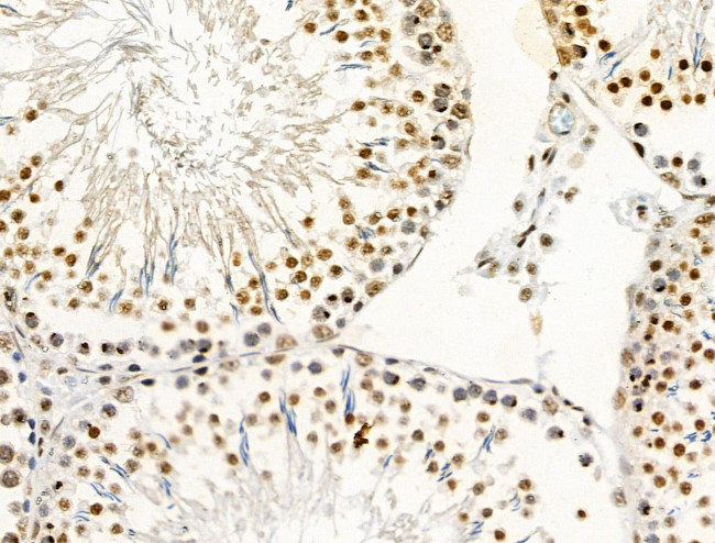 Phospho-PAR4 (Thr163) Antibody in Immunohistochemistry (Paraffin) (IHC (P))