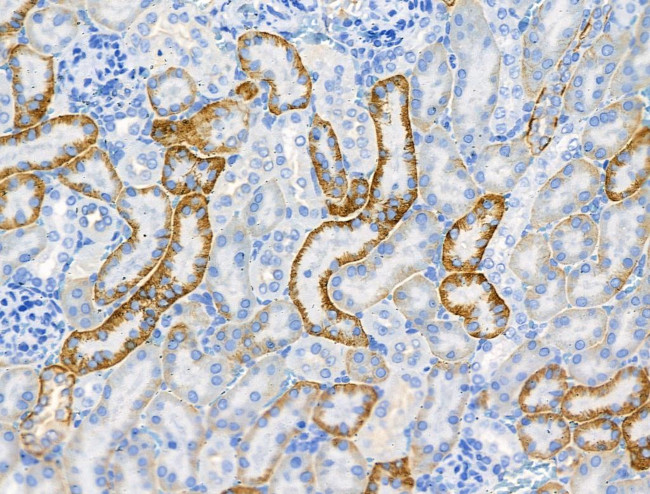 Phospho-NEDD4L (Ser342) Antibody in Immunohistochemistry (Paraffin) (IHC (P))