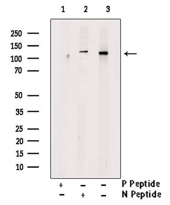 Phospho-NEDD4L (Ser342) Antibody in Western Blot (WB)