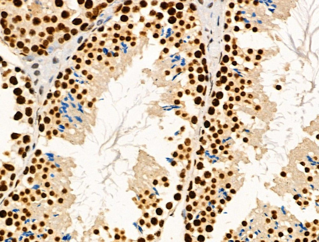 Phospho-MNK1 (Thr250, Thr255) Antibody in Immunohistochemistry (Paraffin) (IHC (P))