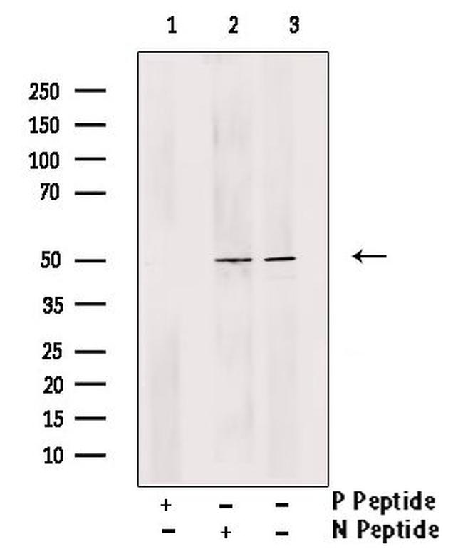 Phospho-MNK1 (Thr250, Thr255) Antibody in Western Blot (WB)