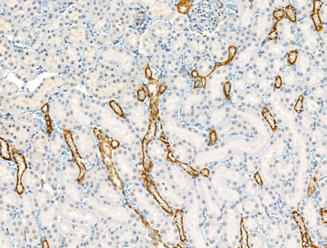 Phospho-CYLD (Ser418) Antibody in Immunohistochemistry (Paraffin) (IHC (P))