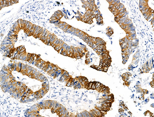 Phospho-PERK (Ser1096) Antibody in Immunohistochemistry (Paraffin) (IHC (P))