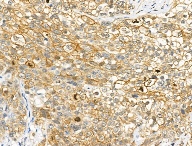 Phospho-GAB2 (Ser159) Antibody in Immunohistochemistry (Paraffin) (IHC (P))