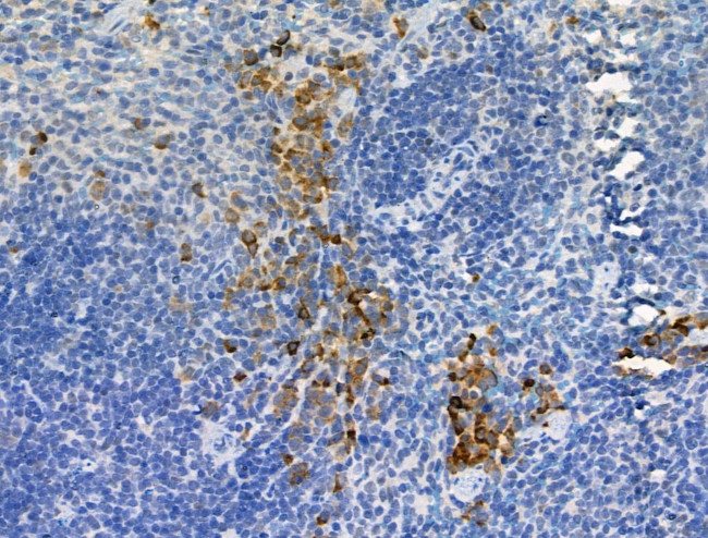 Phospho-GAB2 (Ser159) Antibody in Immunohistochemistry (Paraffin) (IHC (P))