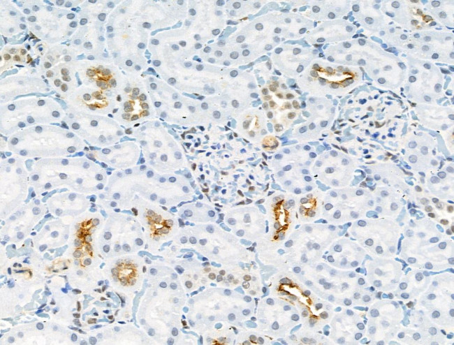 Phospho-GAB2 (Ser159) Antibody in Immunohistochemistry (Paraffin) (IHC (P))