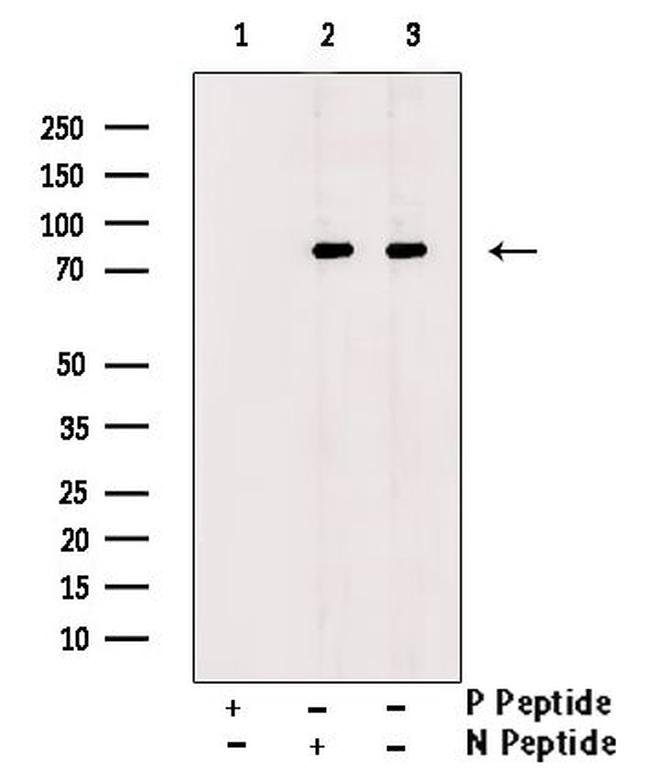 Phospho-GAB2 (Ser159) Antibody in Western Blot (WB)