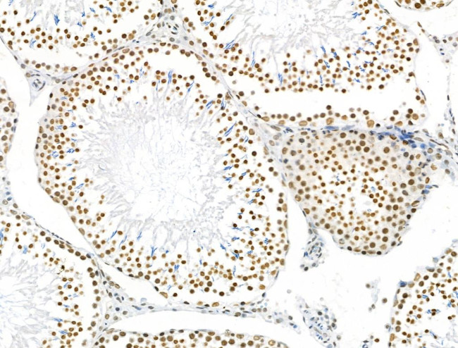 Phospho-NUDC (Ser326) Antibody in Immunohistochemistry (Paraffin) (IHC (P))