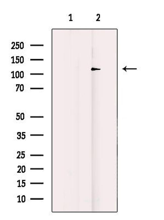 53BP2 Antibody in Western Blot (WB)