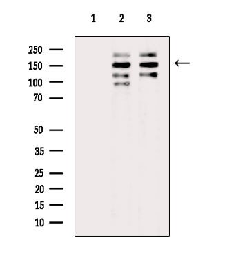 53BP2 Antibody in Western Blot (WB)