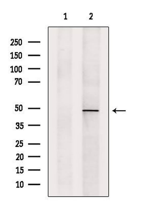 PSMC5 Antibody in Western Blot (WB)