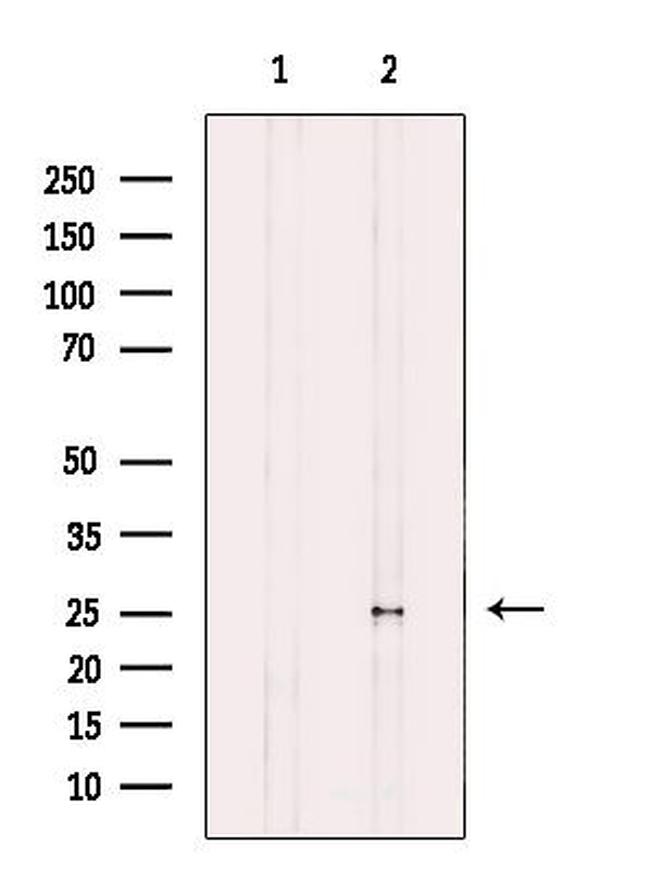 MOB4A Antibody in Western Blot (WB)