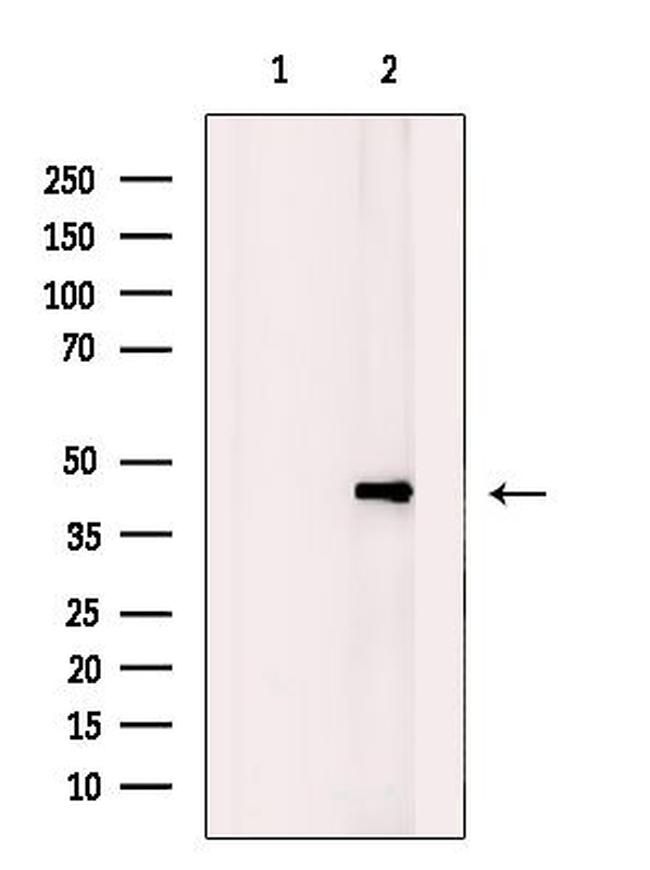 BABAM1 Antibody in Western Blot (WB)