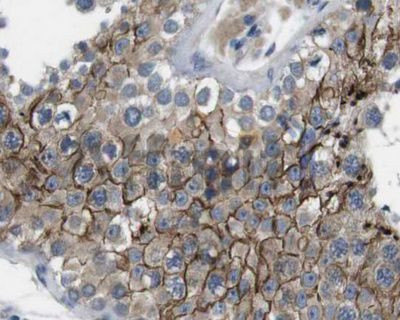 JAK1 Antibody in Immunohistochemistry (Paraffin) (IHC (P))