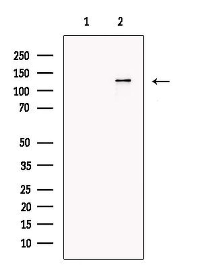 JAK1 Antibody in Western Blot (WB)