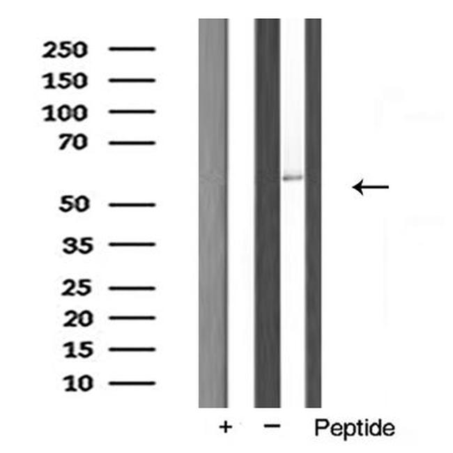 FASTK Antibody in Western Blot (WB)