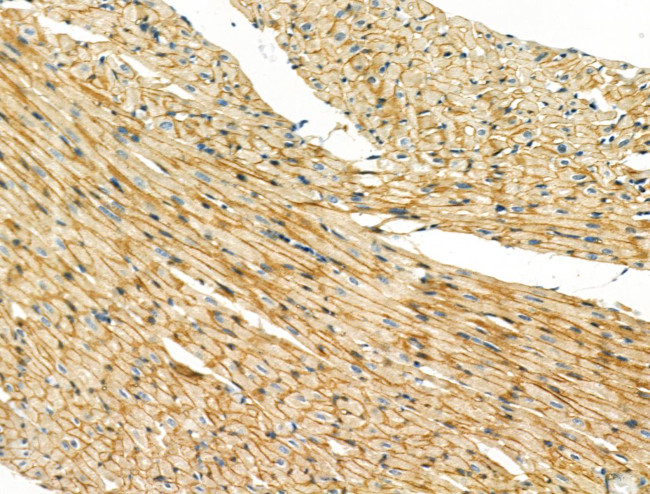 B3GAT1 Antibody in Immunohistochemistry (Paraffin) (IHC (P))