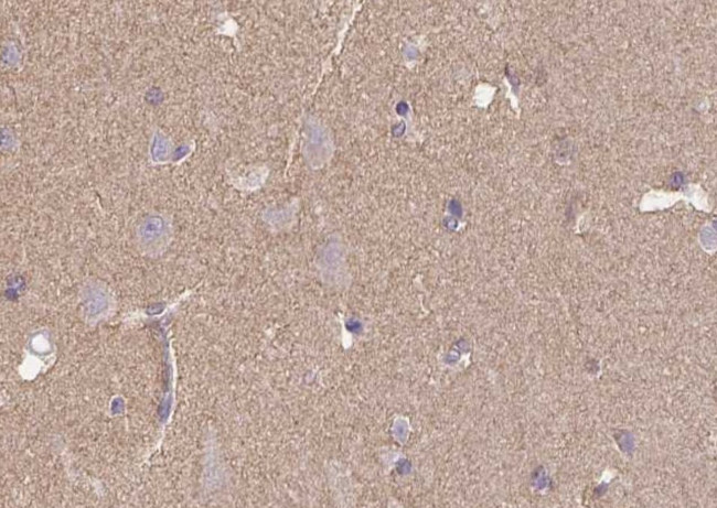 B3GAT1 Antibody in Immunohistochemistry (Paraffin) (IHC (P))