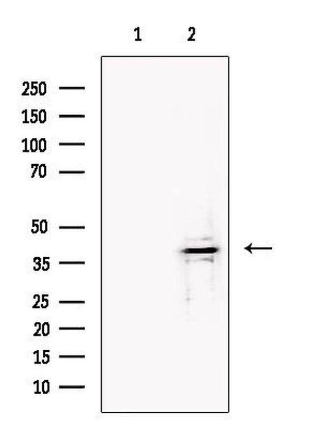 B3GAT1 Antibody in Western Blot (WB)