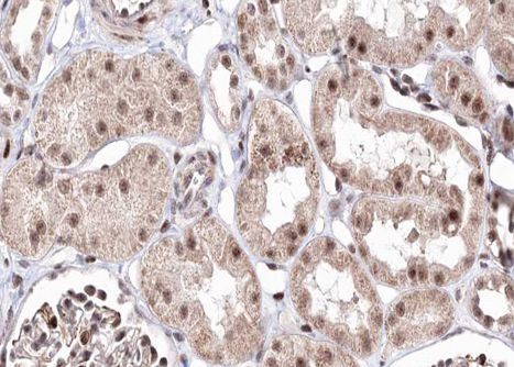 BMP-7 Antibody in Immunohistochemistry (Paraffin) (IHC (P))