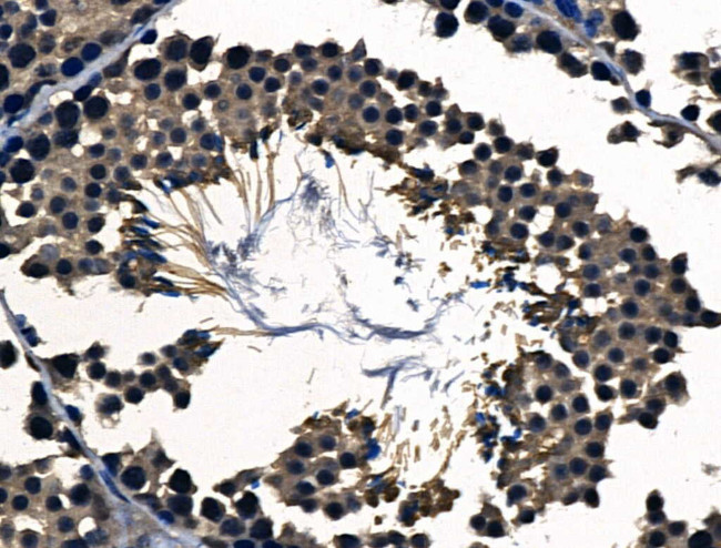 BMP-7 Antibody in Immunohistochemistry (Paraffin) (IHC (P))