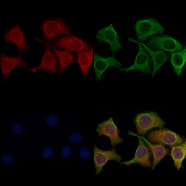 Aquaporin 0 Antibody in Immunocytochemistry (ICC/IF)