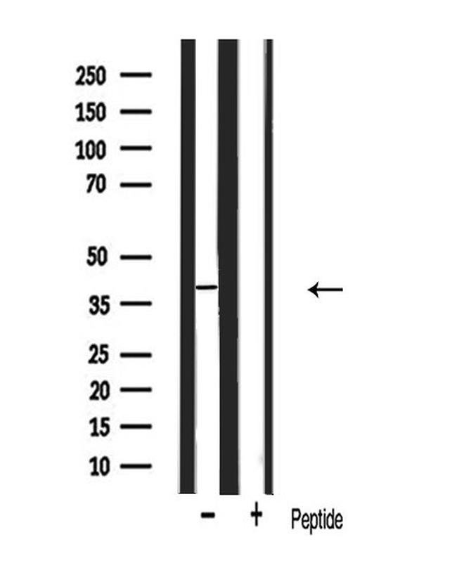 Aquaporin 0 Antibody in Western Blot (WB)