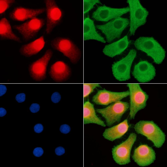 n-Myc Antibody in Immunocytochemistry (ICC/IF)