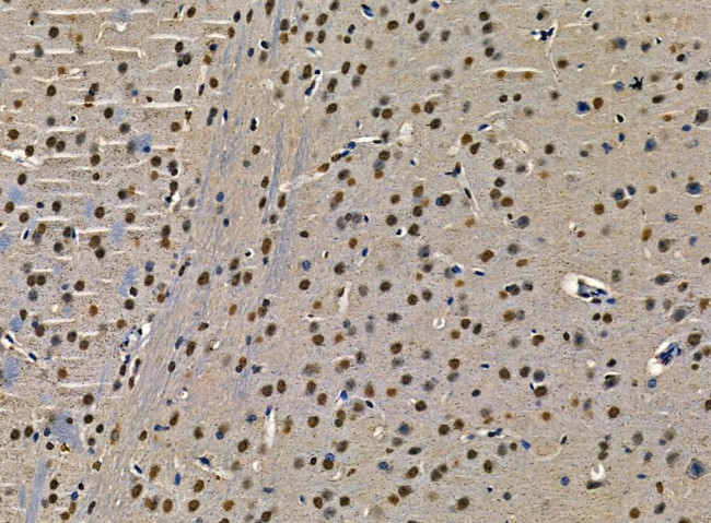 n-Myc Antibody in Immunohistochemistry (Paraffin) (IHC (P))