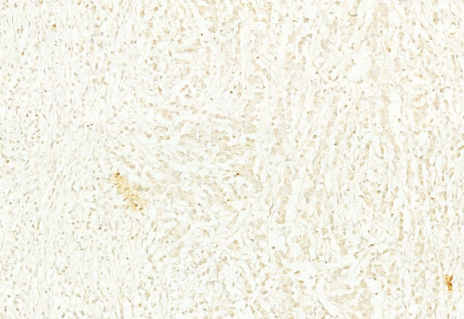 n-Myc Antibody in Immunohistochemistry (Paraffin) (IHC (P))