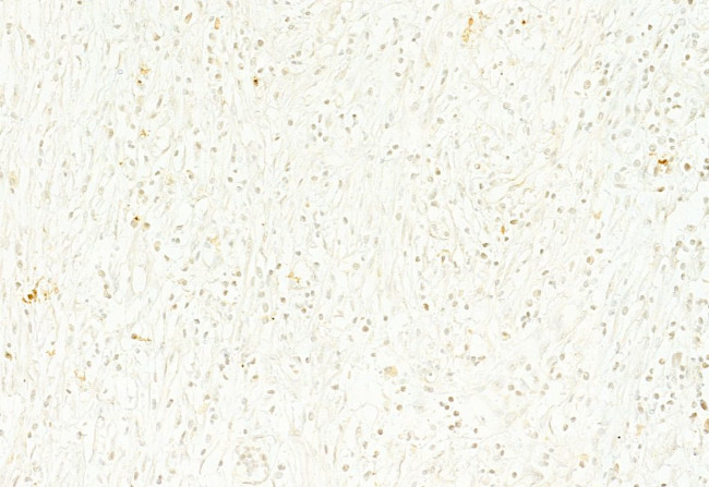 n-Myc Antibody in Immunohistochemistry (Paraffin) (IHC (P))