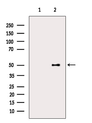 n-Myc Antibody in Western Blot (WB)