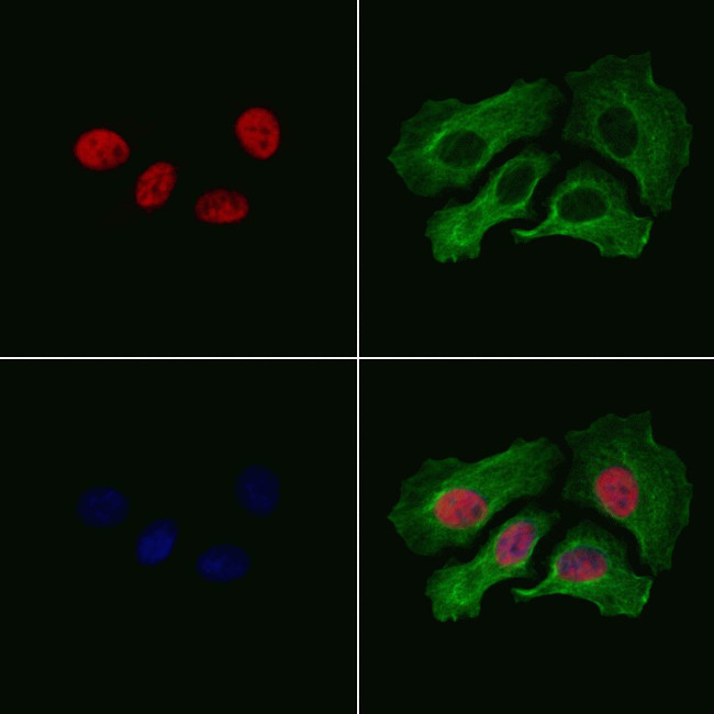 n-Myc Antibody in Immunocytochemistry (ICC/IF)