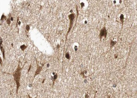 n-Myc Antibody in Immunohistochemistry (Paraffin) (IHC (P))