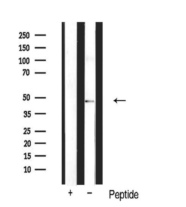 n-Myc Antibody in Western Blot (WB)