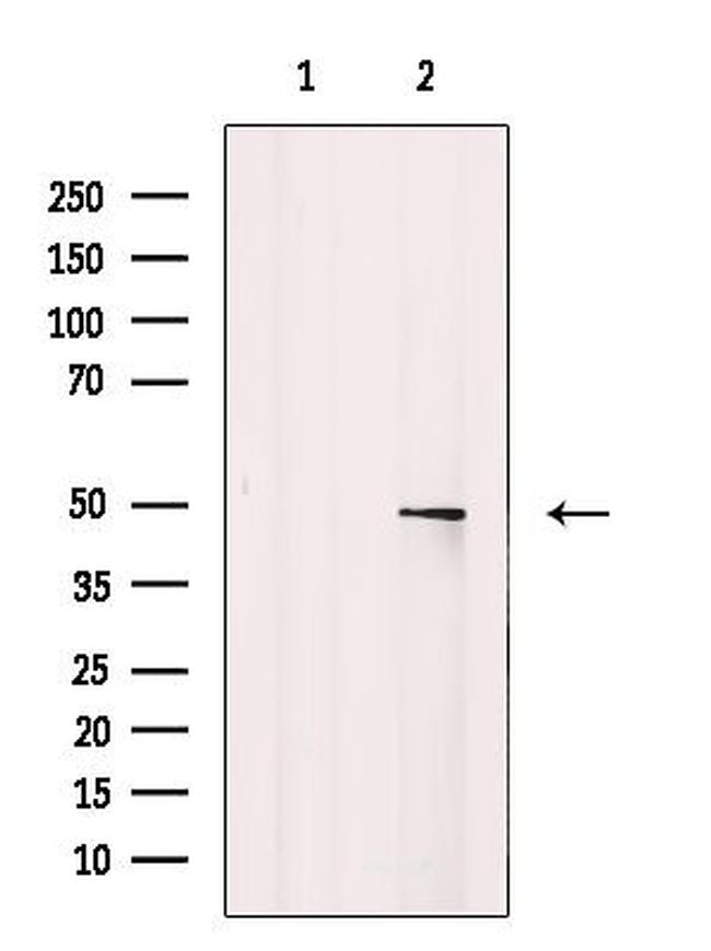 n-Myc Antibody in Western Blot (WB)