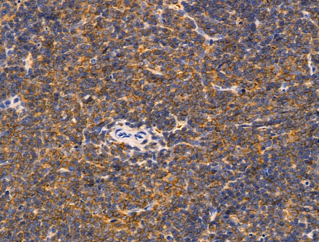 DCT Antibody in Immunohistochemistry (Paraffin) (IHC (P))