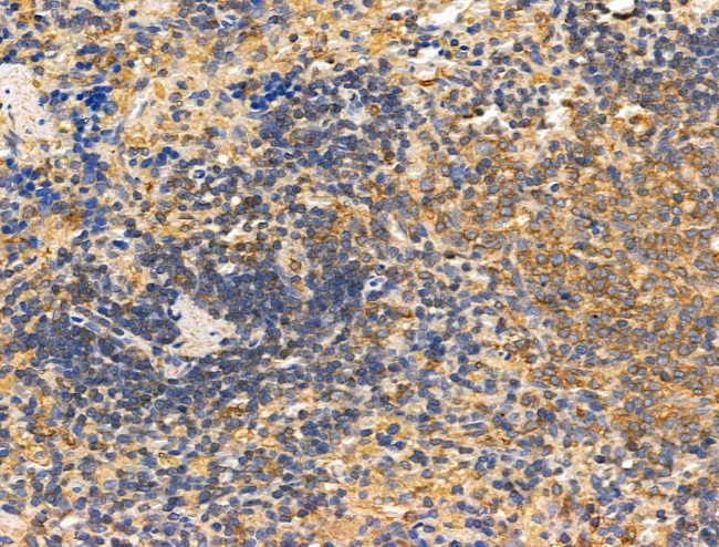 DCT Antibody in Immunohistochemistry (Paraffin) (IHC (P))