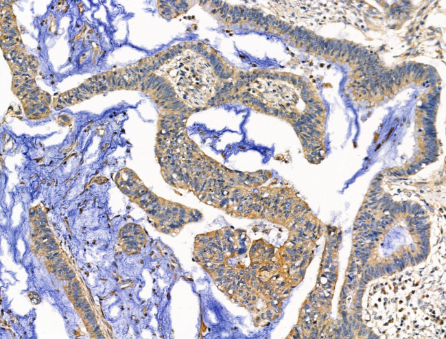 EDG2 Antibody in Immunohistochemistry (Paraffin) (IHC (P))